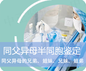 大理同父异母半同胞鉴定
